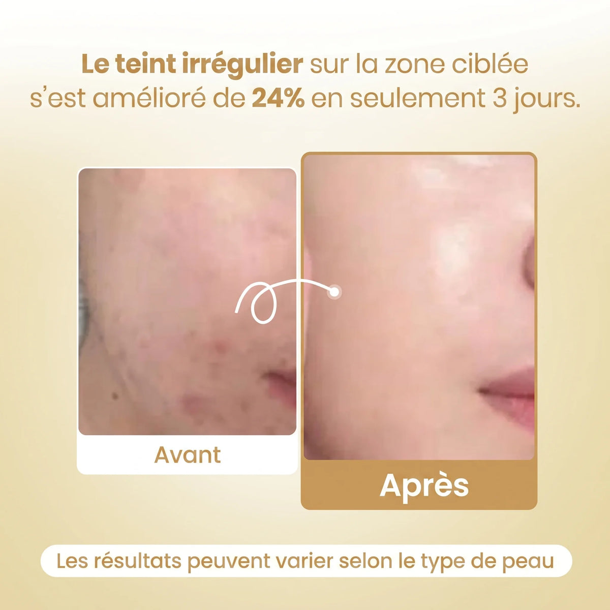 Masque Acide Kojique au Curcuma